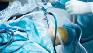 Operación para el reemplazo de rodilla